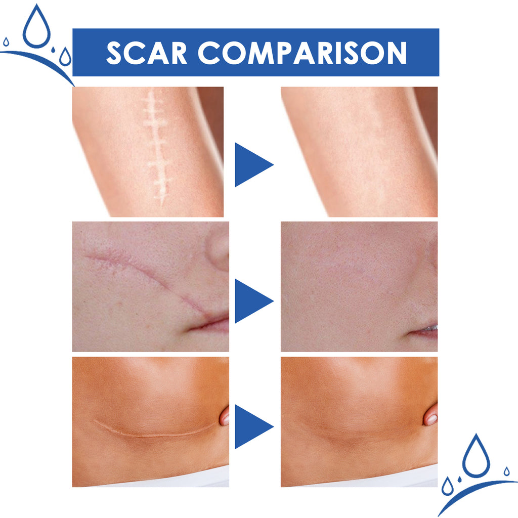 Jaysuing Scar Cream, Fade Scars Smooth And Firming Skin Repair Cream