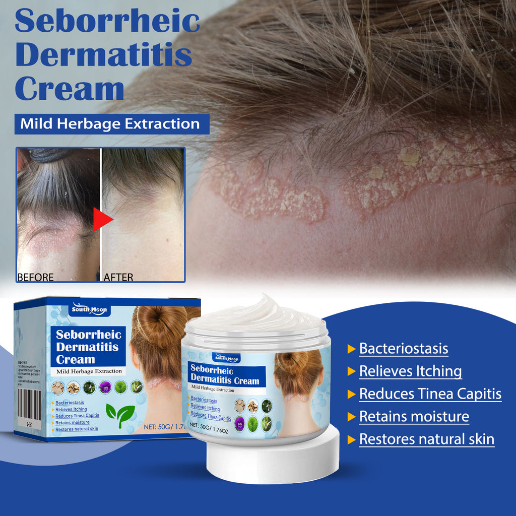 South Moon Skin Care Cream Gently Improve Scalp And Head Acne Skin Problems Care Cream
