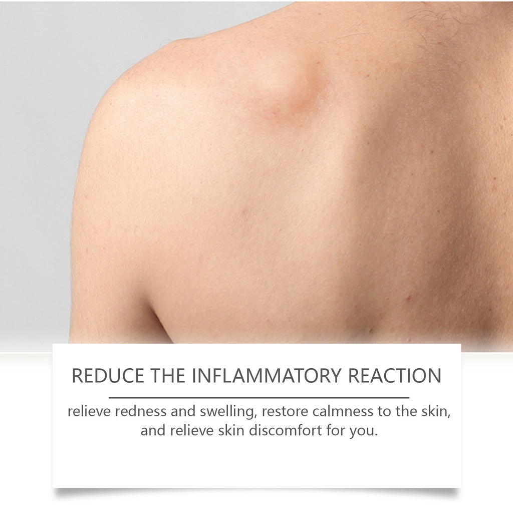 South Moon Body Care Drops Gently Remove Clumps And Repair The Back Of Legs To Restore Smooth Body
