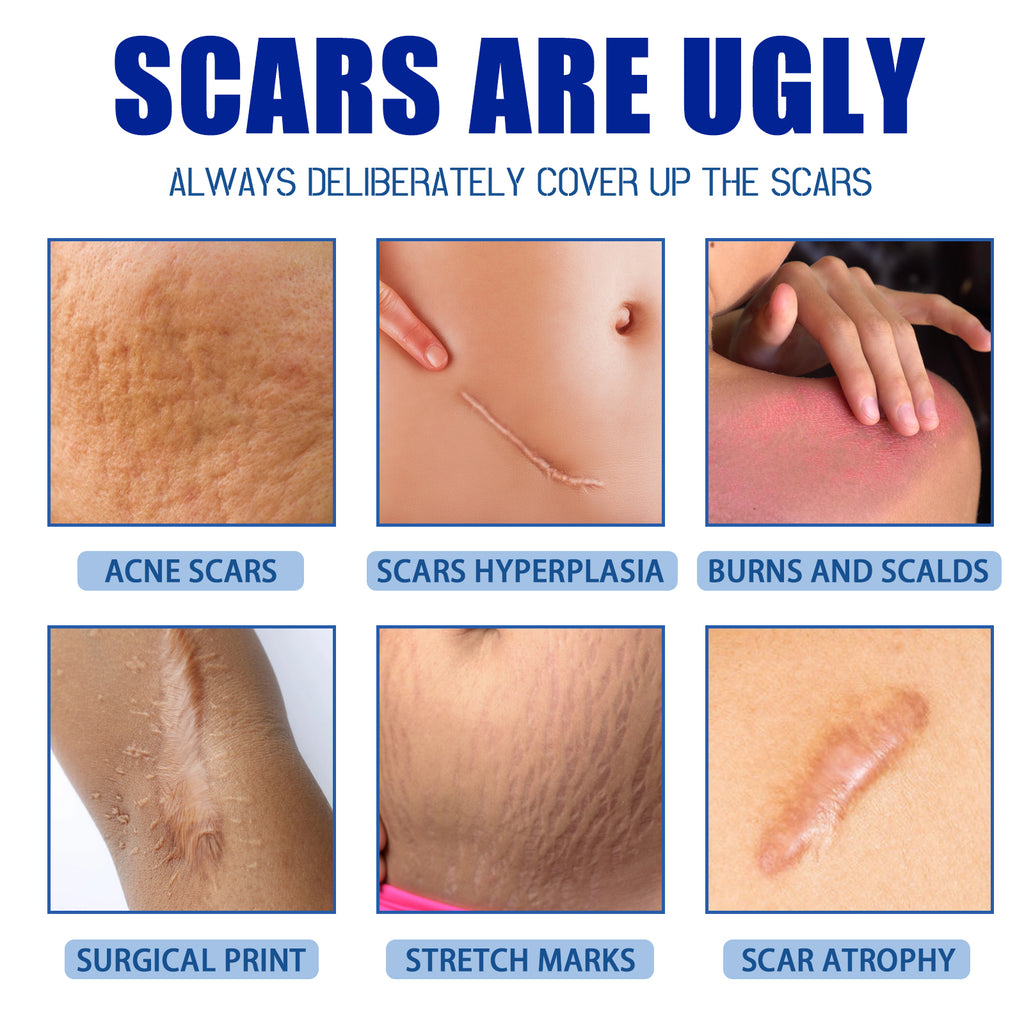 Jaysuing Scar Cream, Fade Scars Smooth And Firming Skin Repair Cream