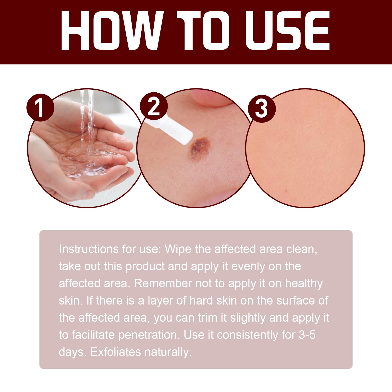 Acetic Acid Smoothing Pen