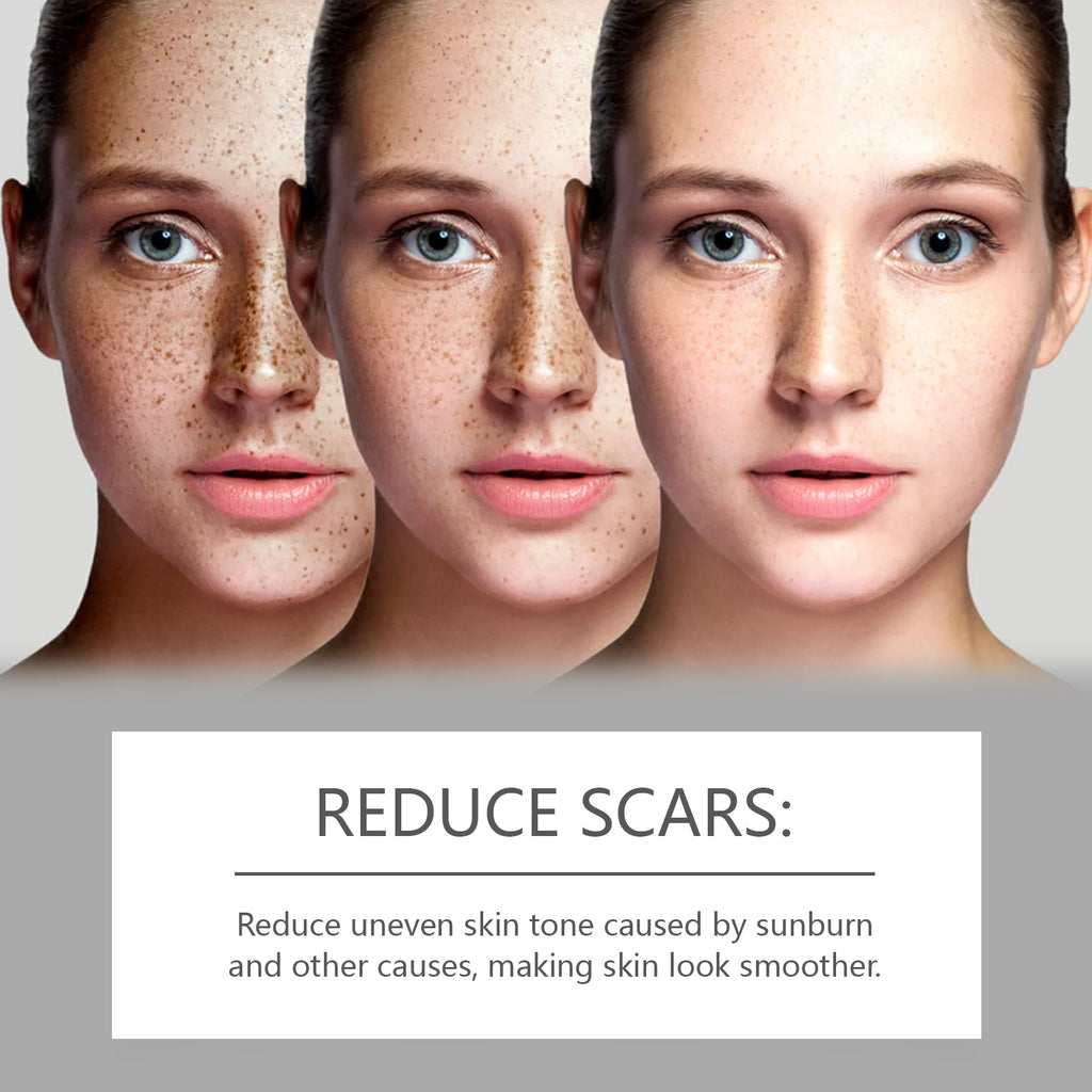 West&Month Skin Repair Serum Gently Moisturizes Facial Skin, Improves Dull And Brightening Skin Care Essence